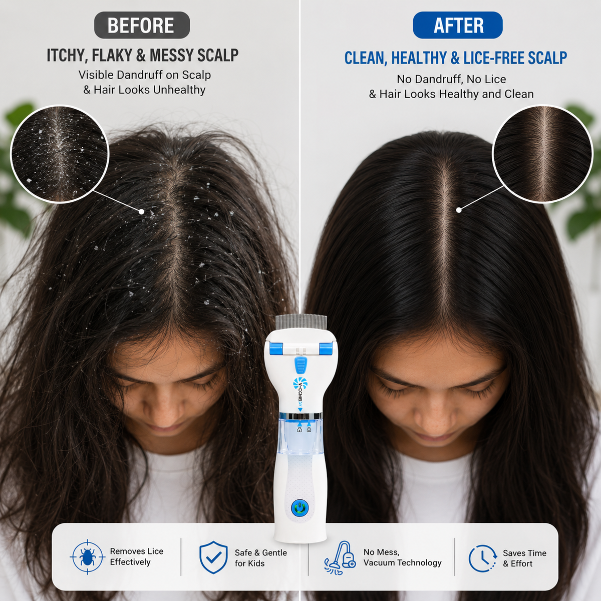 Electric Chemical-Free Head Lice Removal Comb