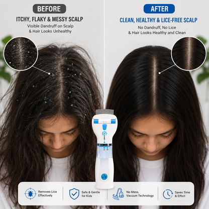Electric Chemical-Free Head Lice Removal Comb