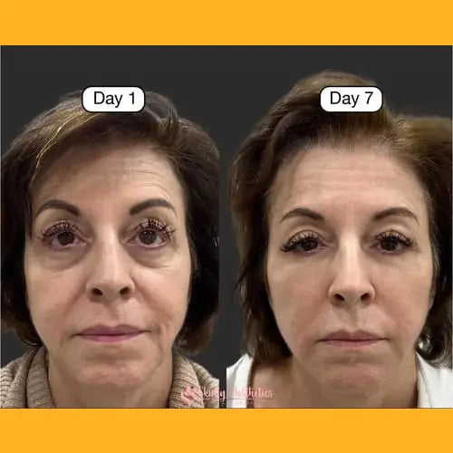 Lymphatic Contour Face Brush